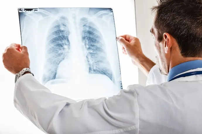 AVANCE MÉDICO SIN PRECEDENTES: HOMBRE SOBREVIVE 48 HORAS SIN PULMONES GRACIAS A UN ÓRGANO ARTIFICIAL
